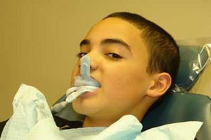 a patient receiving a fluoride treatment tx