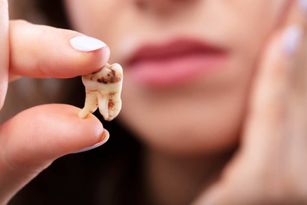 tooth decay a woman learns how to prevent tooth decay