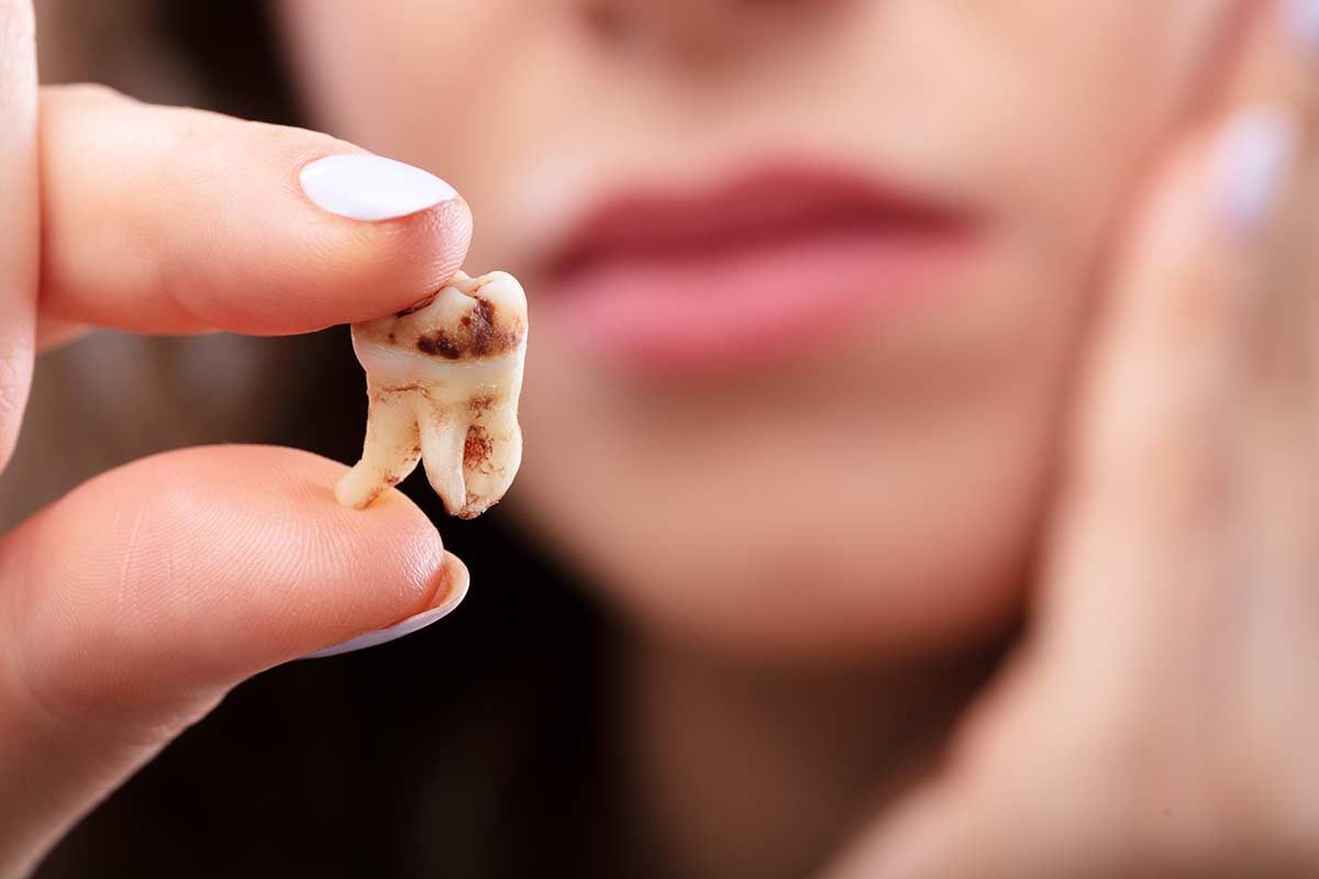 tooth decay a woman learns how to prevent tooth decay