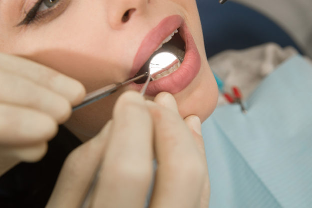 a doctor explaining how treating a chipped tooth
