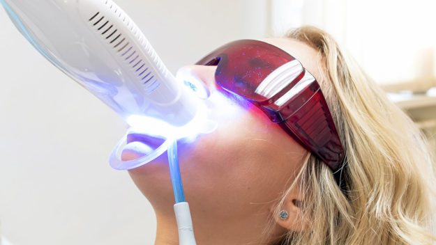 a woman undergoing different teeth whitening options
