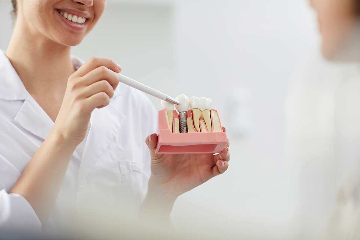 dental implants a dentist holds a model of dental implants