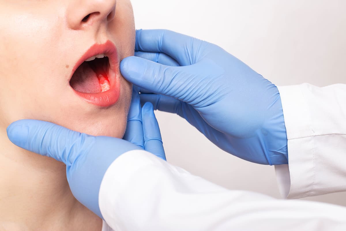 gum disease dentist checking for gum disease