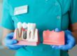 a model represents a single tooth implant