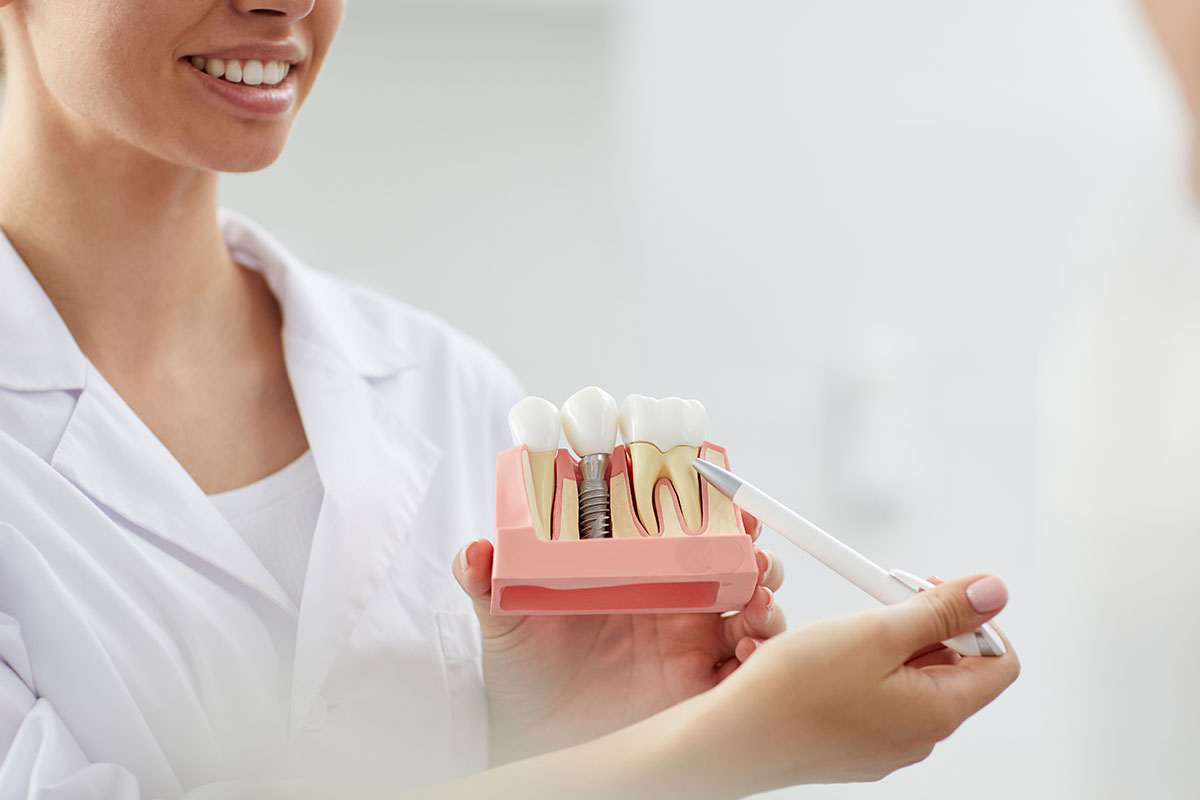 dentist explaining a dental implant