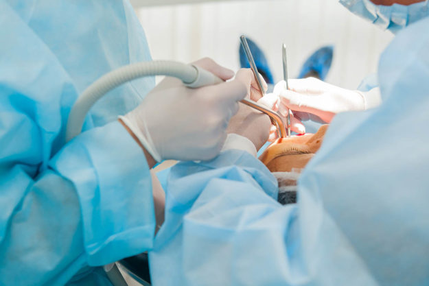 4 Common Types of Oral Surgeries (3) dentists performing oral surgeries