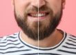 man experiencing the benefits of dental veneers